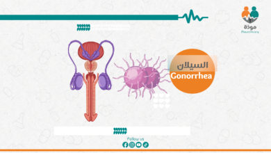 السيلان