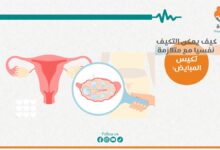 متلازمة تكيُّس المبايض