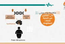 متلازمة برادر ويلي