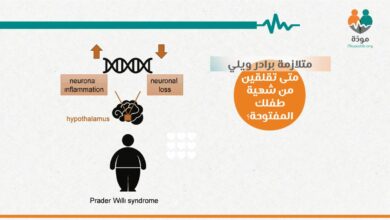 متلازمة برادر ويلي