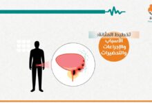 اختبار تخطيط المثانة