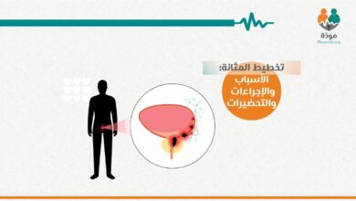 اختبار تخطيط المثانة