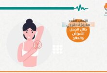 التهاب الغدد العرقيَّة القيحي