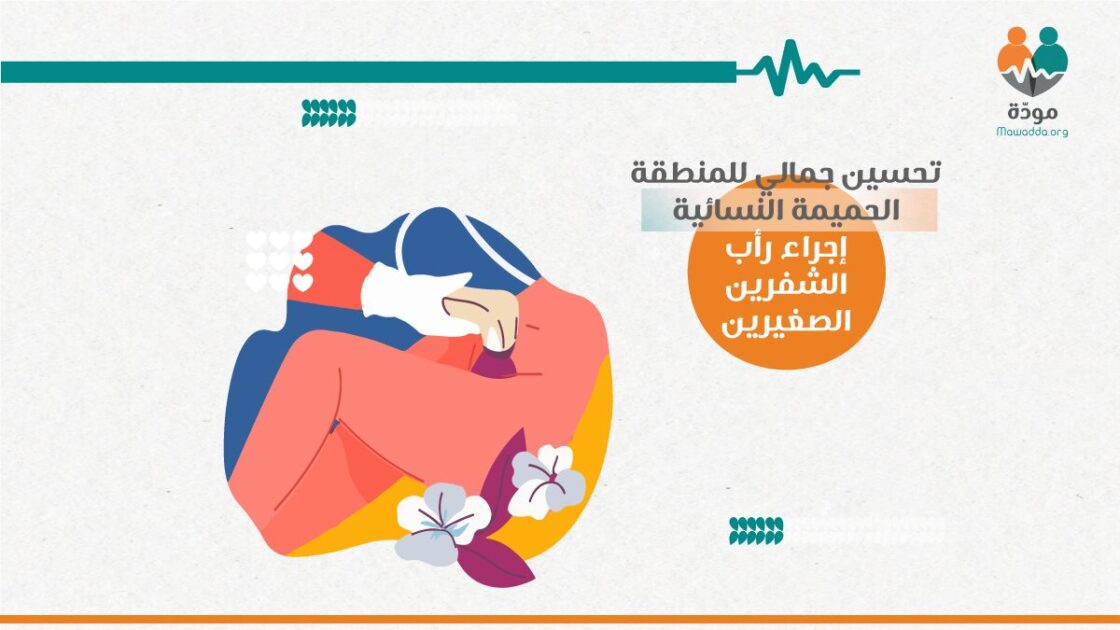 تجميل تناسلي